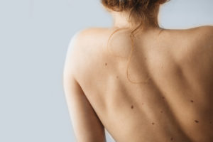 Body