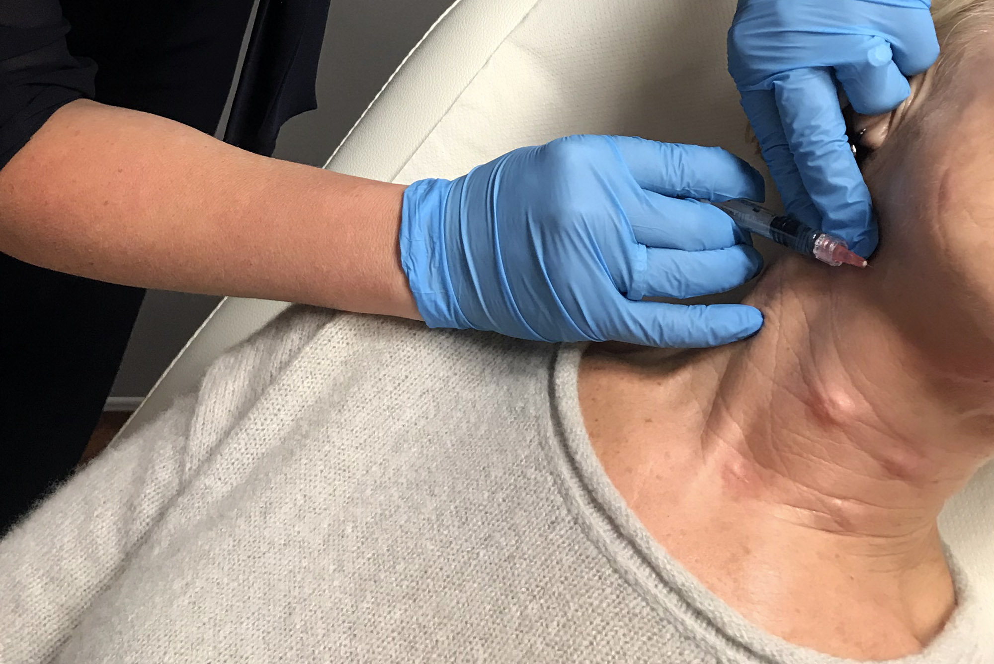 Neck treatment with Profhilo collagen booster