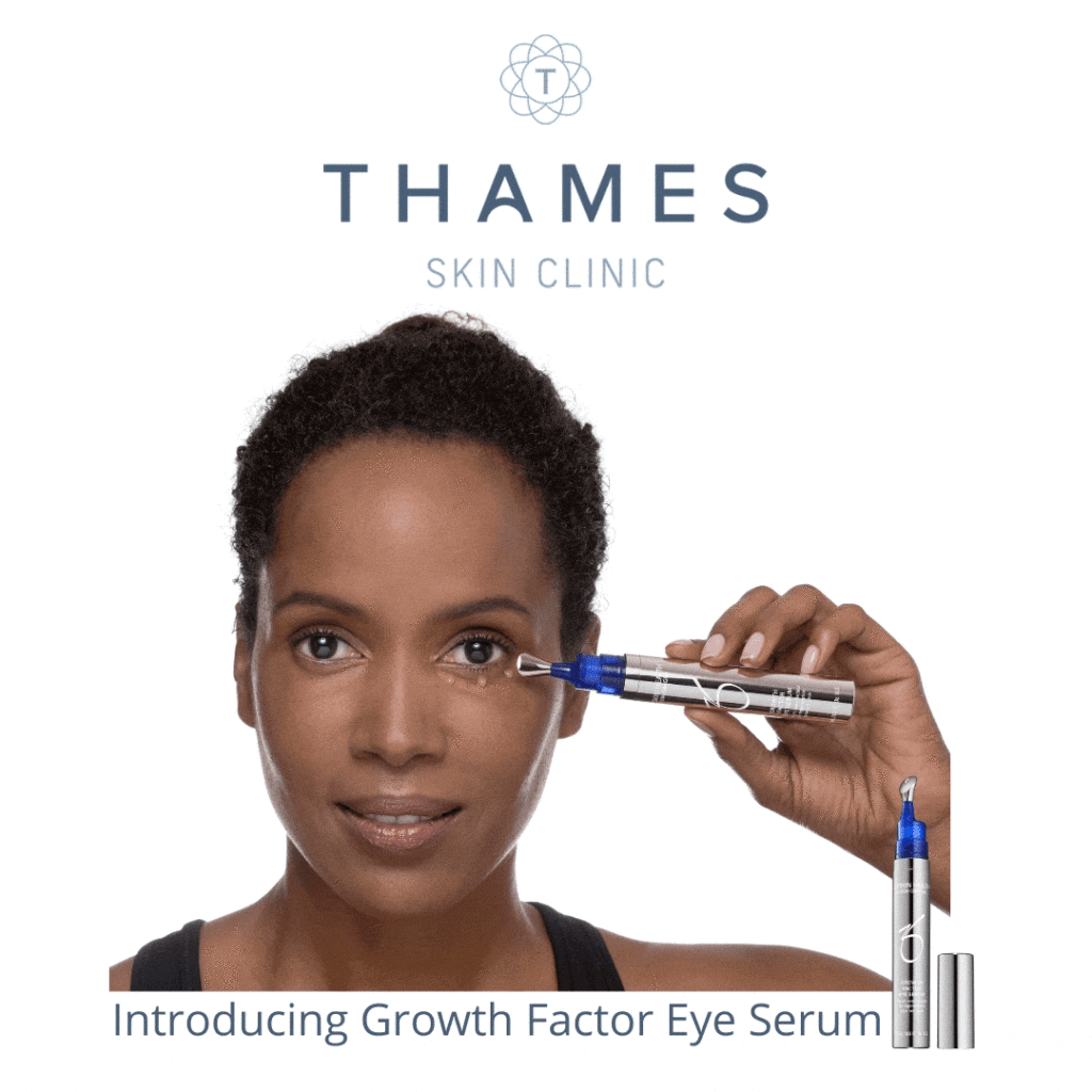Introducing Growth Factor Eye Serum - Zo Skin Health Twickenham | Thames  Skin Clinic