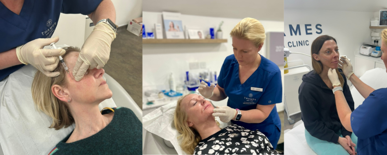 Dr Anna Hemming Dermal Filler Treatment