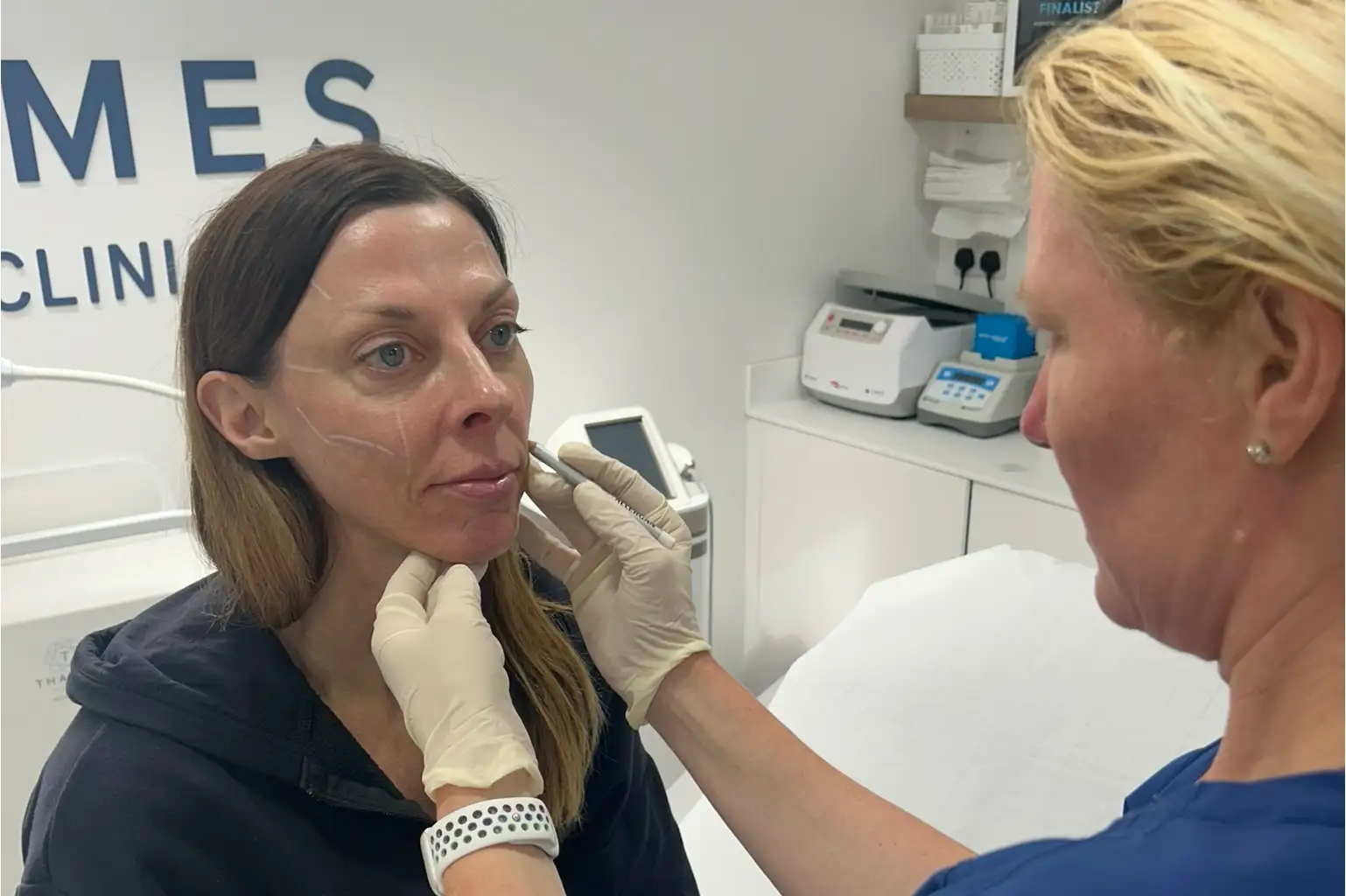 PRP Filler showing Doctor and patient